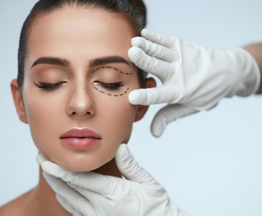 Imagem Blefaroplastia